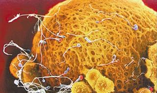 内裤上褐色分泌物怎么回事 正常褐色分泌物图片